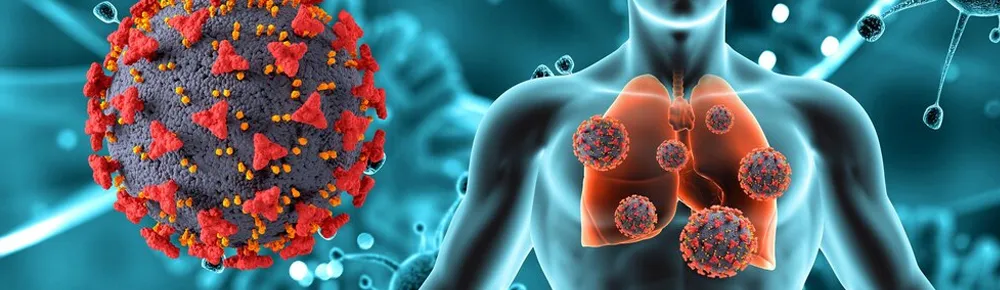 Carcinoid Cancer Image