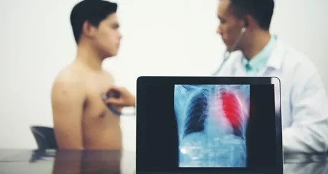 Targeted Therapy Treatment Image